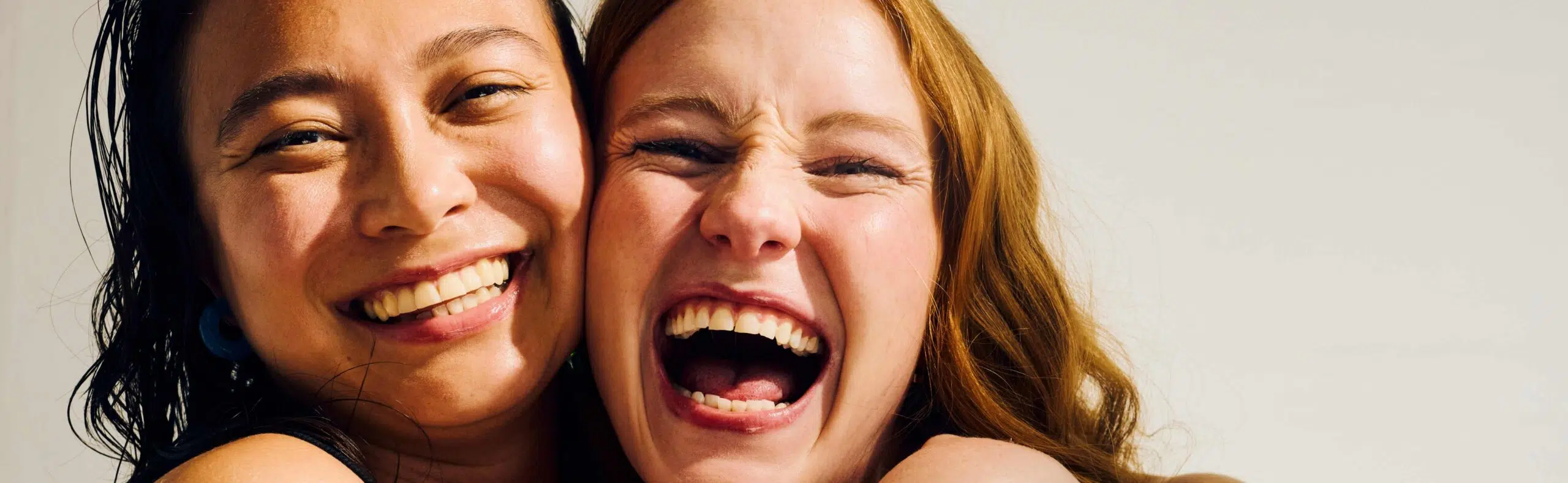 Les zones du visage les plus courantes pour des injections de botox (B) ou d’acide hyaluronique (AH)