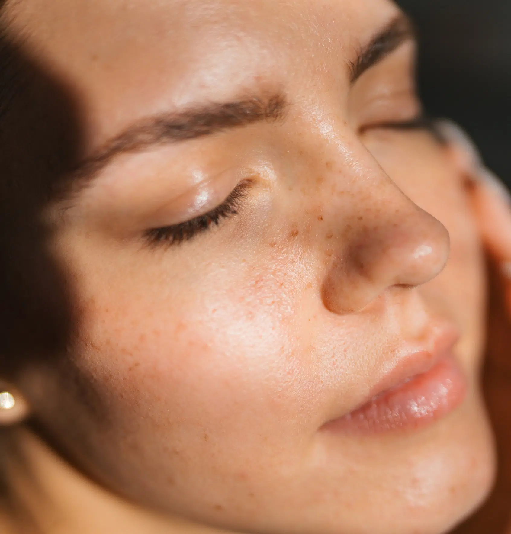 Chirurgie du visage